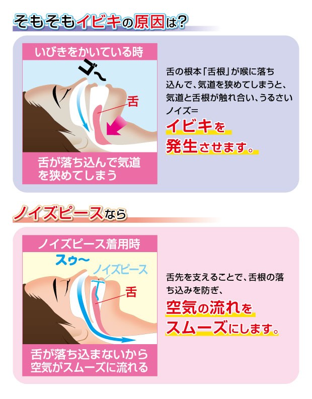 ノイズピースなら空気の流れをスムーズにします