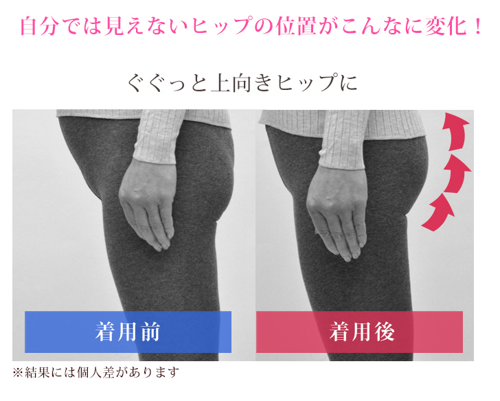 ガードル