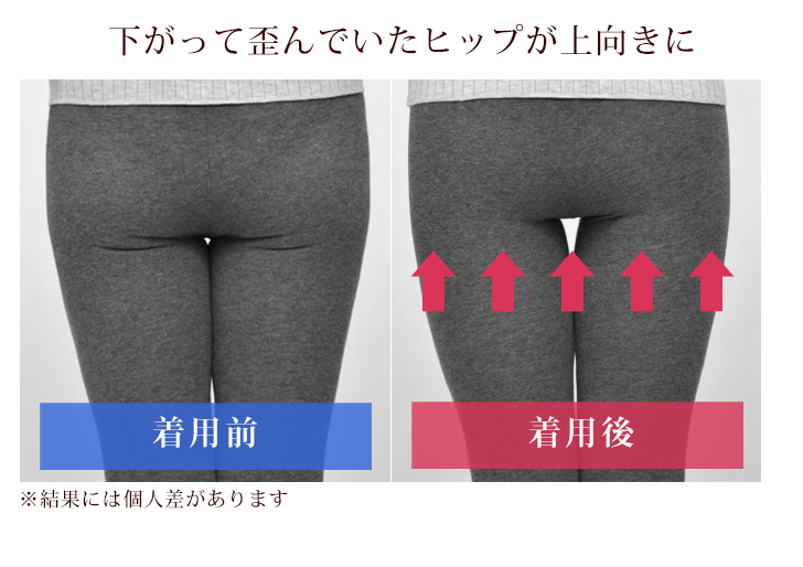 ガードル