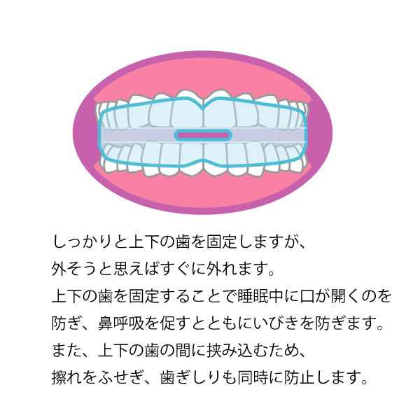 最大24%還元 トプラン いびきマウスガード ...の詳細画像4