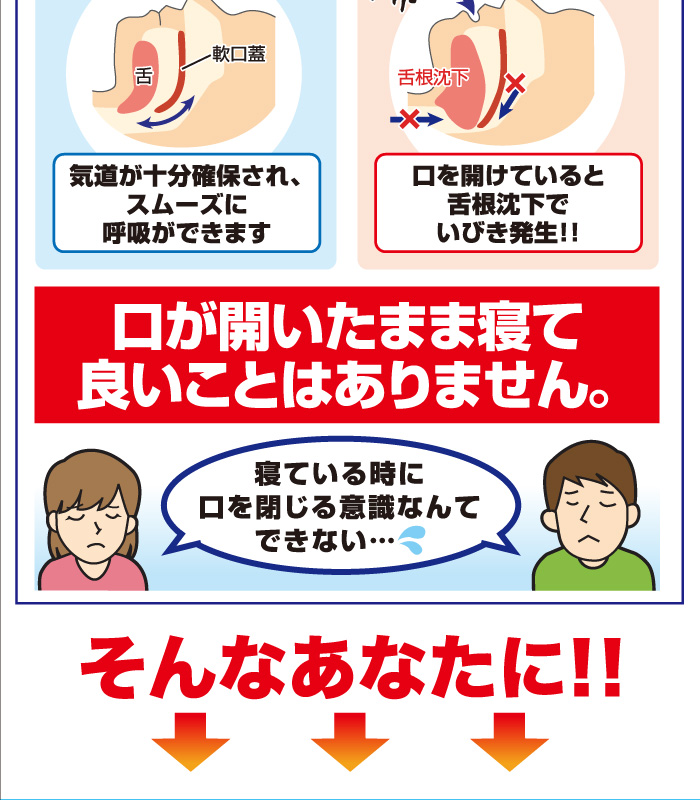 口が開いたまま寝て良いことはありません。