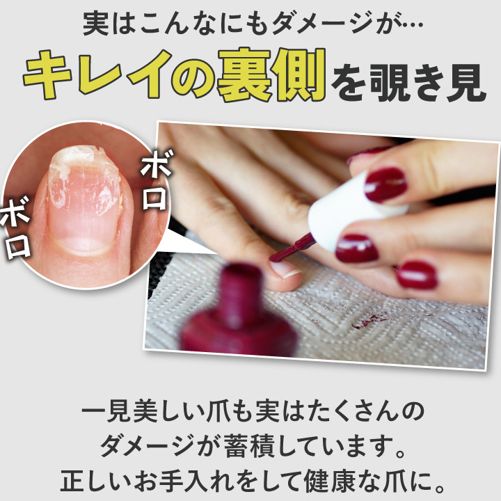 実はこんなんもダメージが　キレイの裏側を覗き見