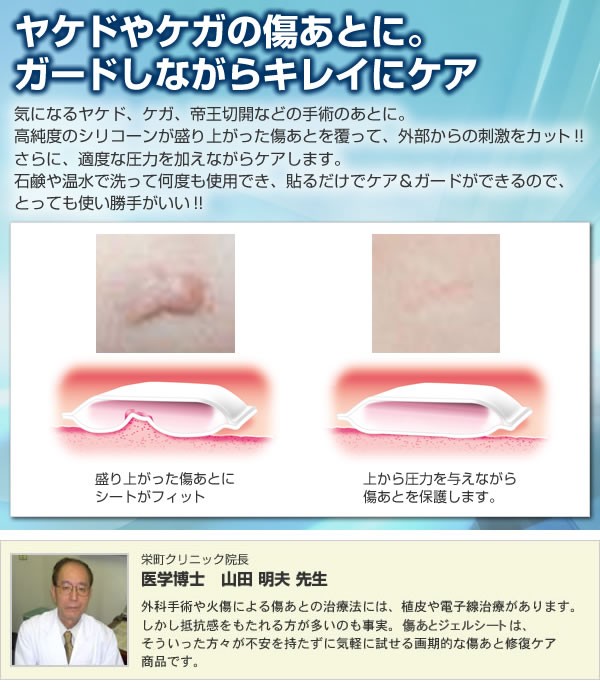 クリニセルS 傷あとケア（火傷 ケガ 手術あと 帝王切開あと） imgrc0086748593.jpg