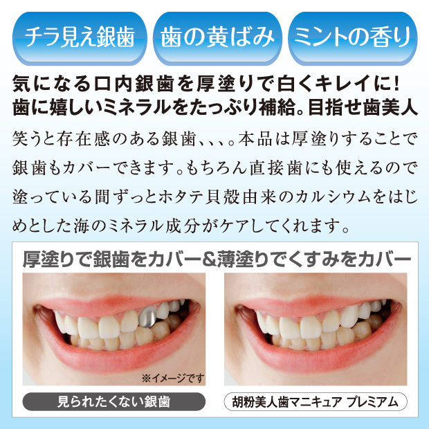 気になる口内銀歯を厚塗りで白くキレイに