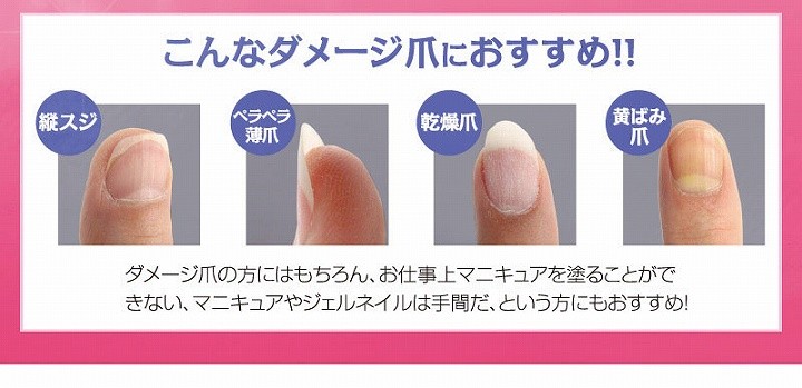こんなダメージ爪にオススメ！！