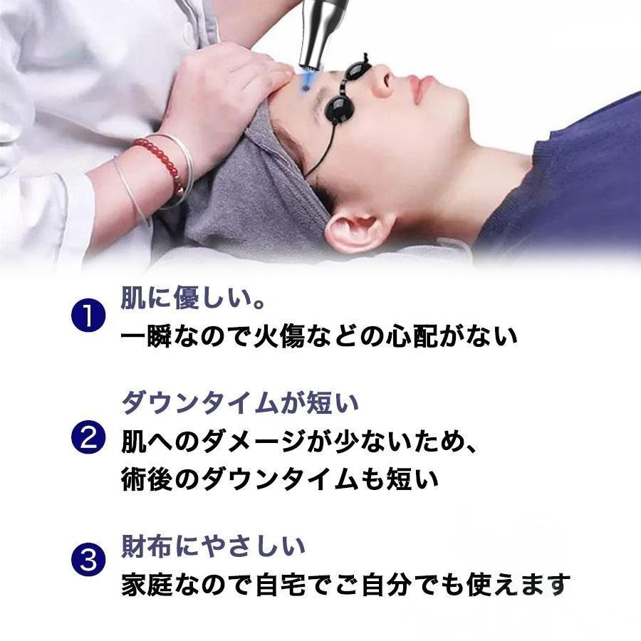 ピコレーザー 美顔器 レーザーペン シミ取り ほくろそばかす除去 シミ