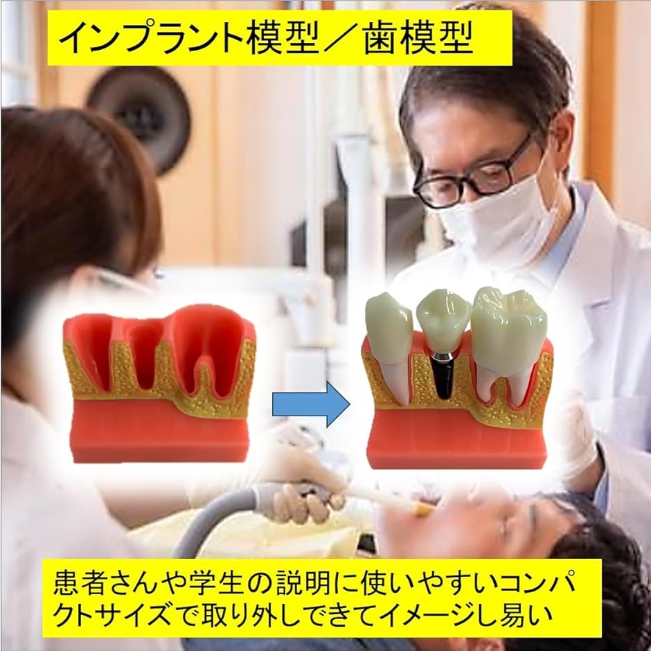 2.5倍大複製根模型歯 [B10-330]｜株式会社ニッシン｜歯科模型・歯科