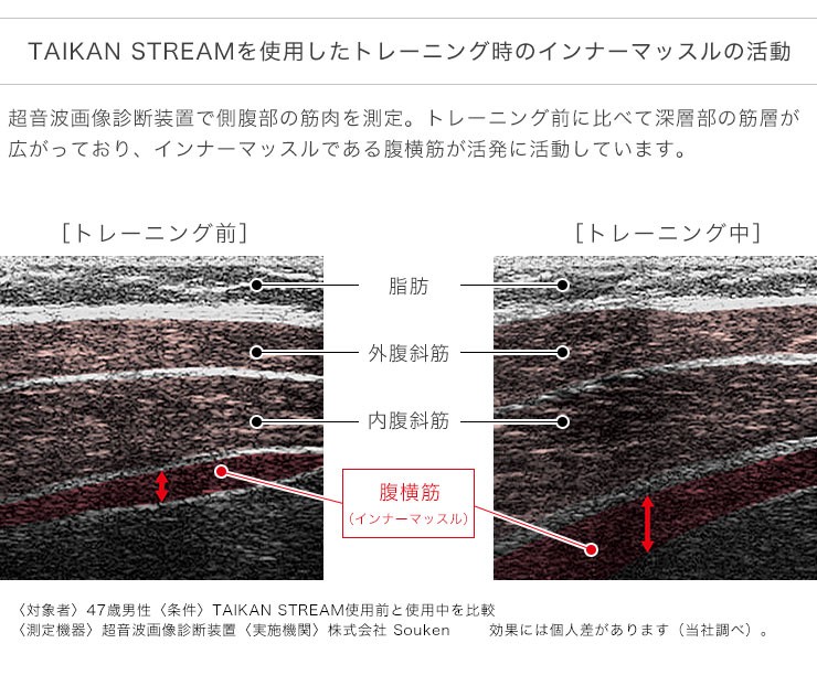 MTG タイカンストリーム アドバンス TAIKAN STREAM ADVANCE 体幹