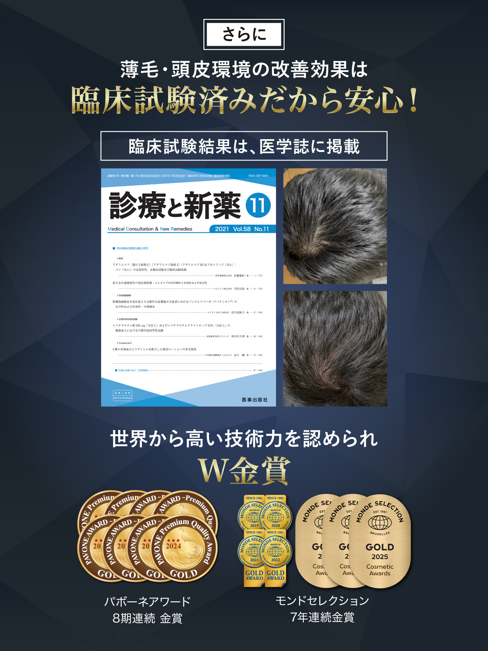 REDEN リデン 育毛剤 5本セット REDEN（リデン） 育毛剤 スカルプケア リデンシル 薬用育毛剤 医薬部外