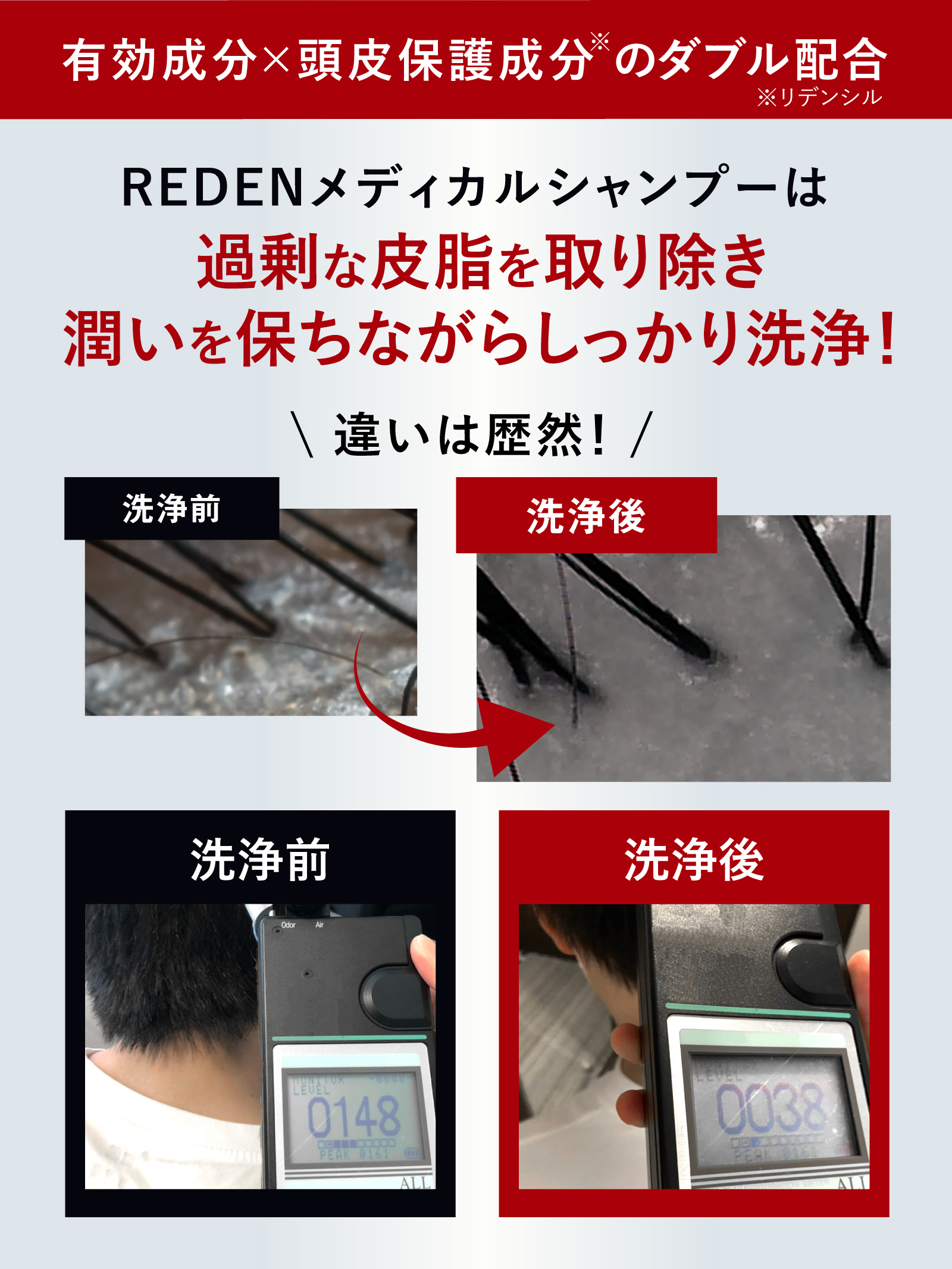 REDEN（リデン） メディカルシャンプー 毛髪診断士(R)監修 3本 濃密泡