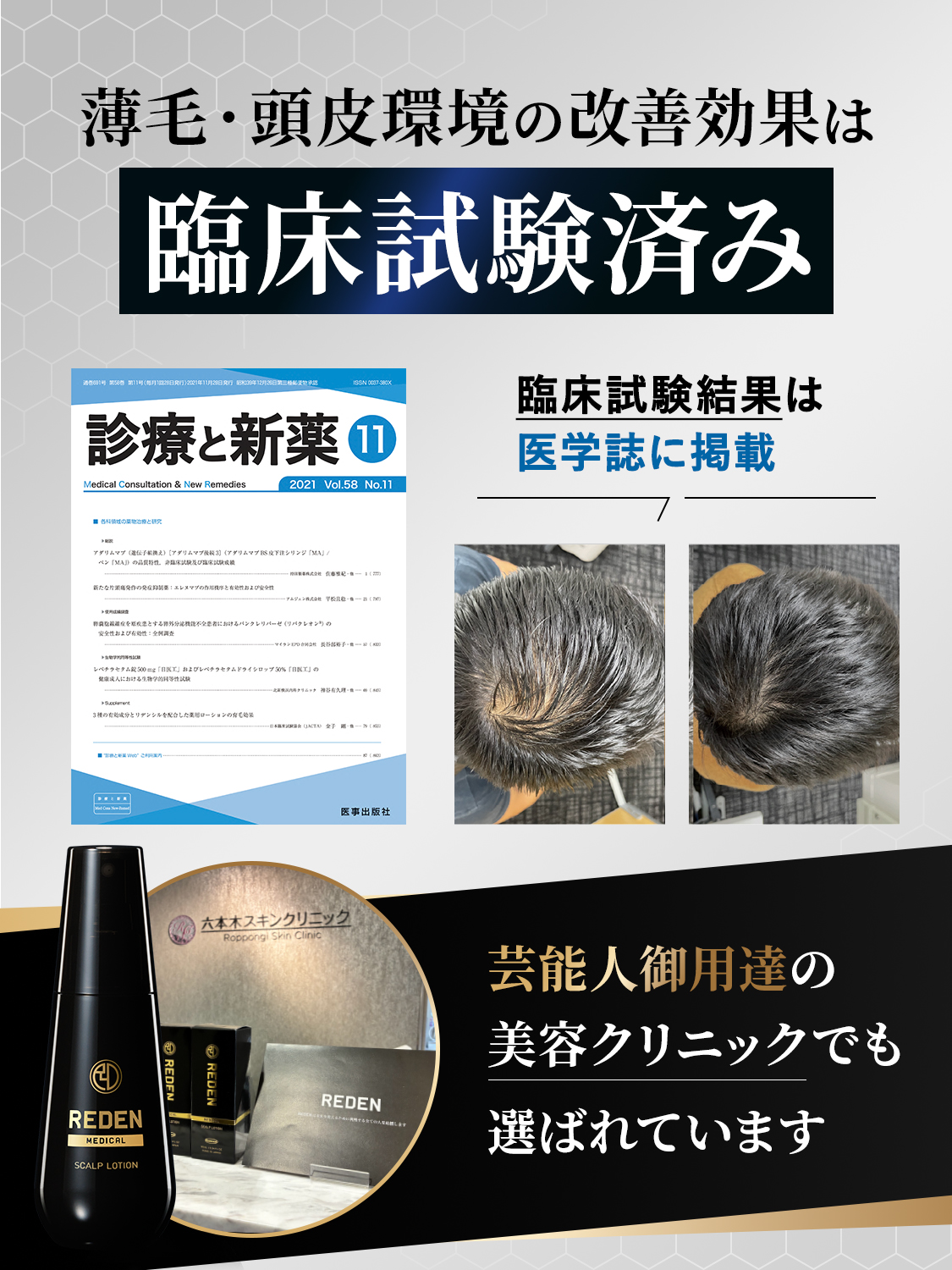 REDEN（リデン） 育毛剤 メンズ 【公式】 スカルプ 育毛 男性 医薬部外