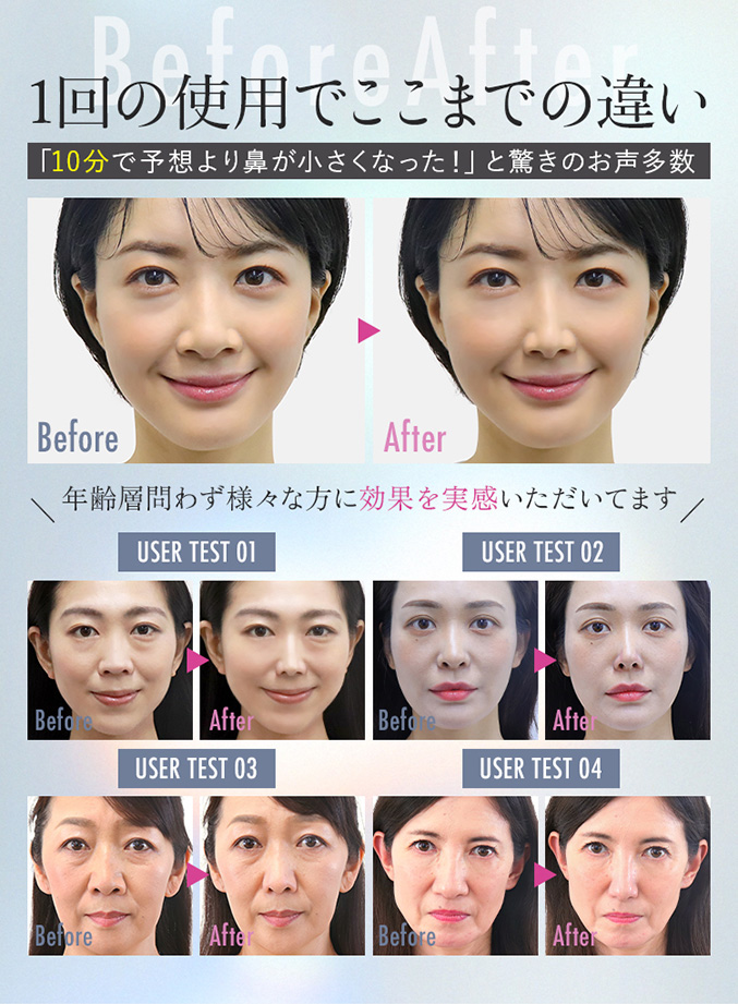 LUXCEAR フォーネス
