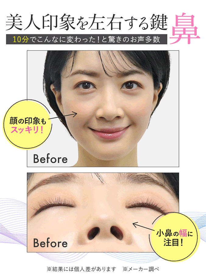 LUXCEAR フォーネス