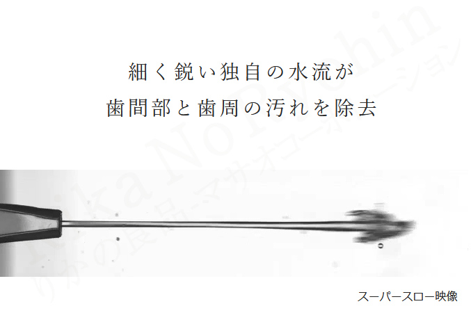 細く鋭い独自の水流が歯間部と歯周の汚れを除去