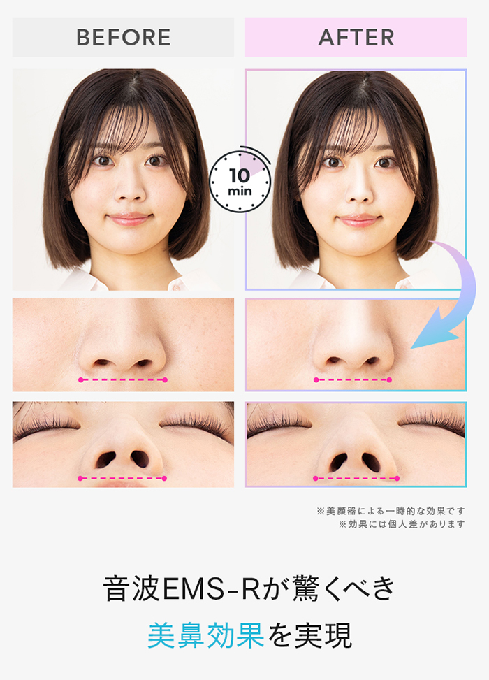LUXCEAR（ルクセア） LUXCEAR Fornez PRO フォーネス プロ 鼻 美顔器