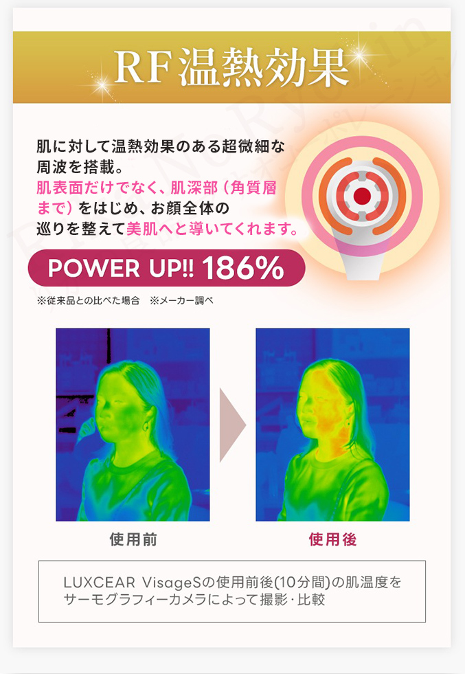RF温熱効果