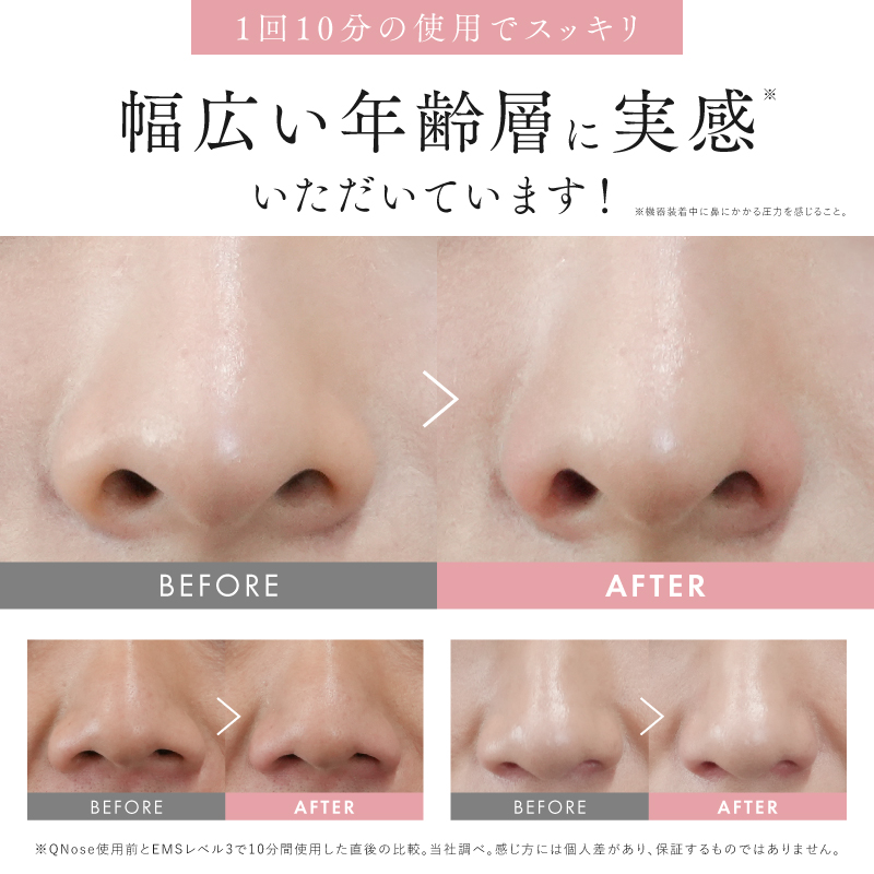 Venus 5 美顔器 日本製 NIPLUX 鼻専用美顔器 QNose キュノーズ 鼻 EMS ノーズクリップ 忘れ鼻