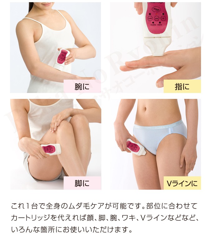 オムニ スーパーワイドフラッシュ スマートデピ フラッシュ脱毛