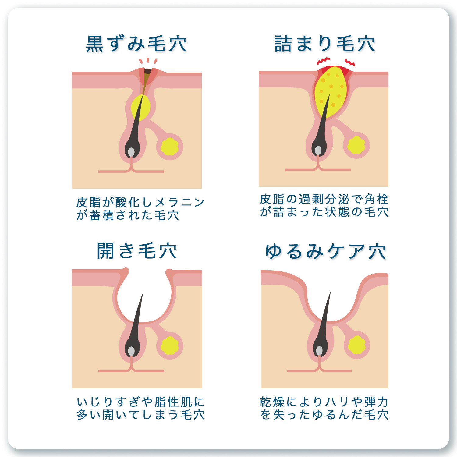 ポアレスエッセンス 100ml 美容液 保湿 ハリ キメ 角質ケア ビタミンC 