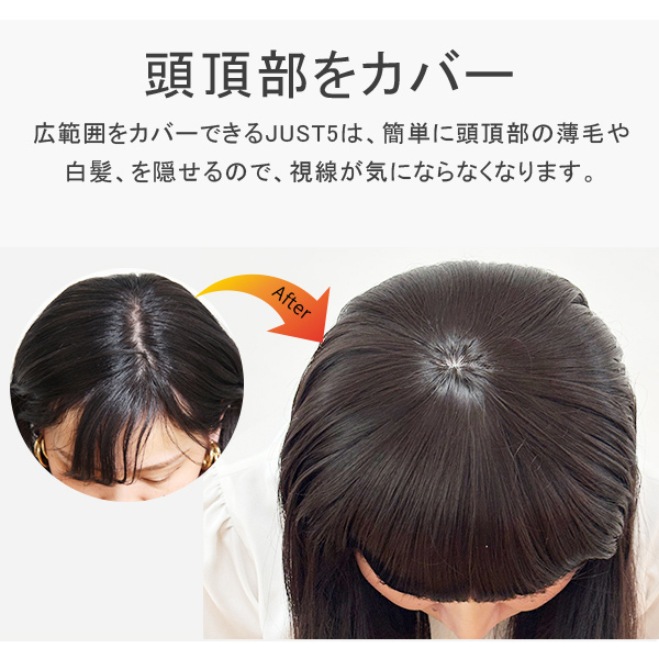 サロン仕上げ カバーウィッグ「安心のカラー交換」部分ウィッグ 頭頂部