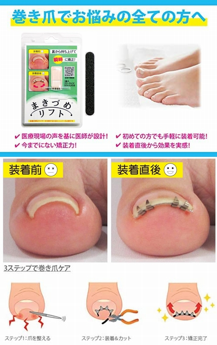 まきづめリフト ヤスリ付 《4本爪、巻き爪 矯正 ワイヤー