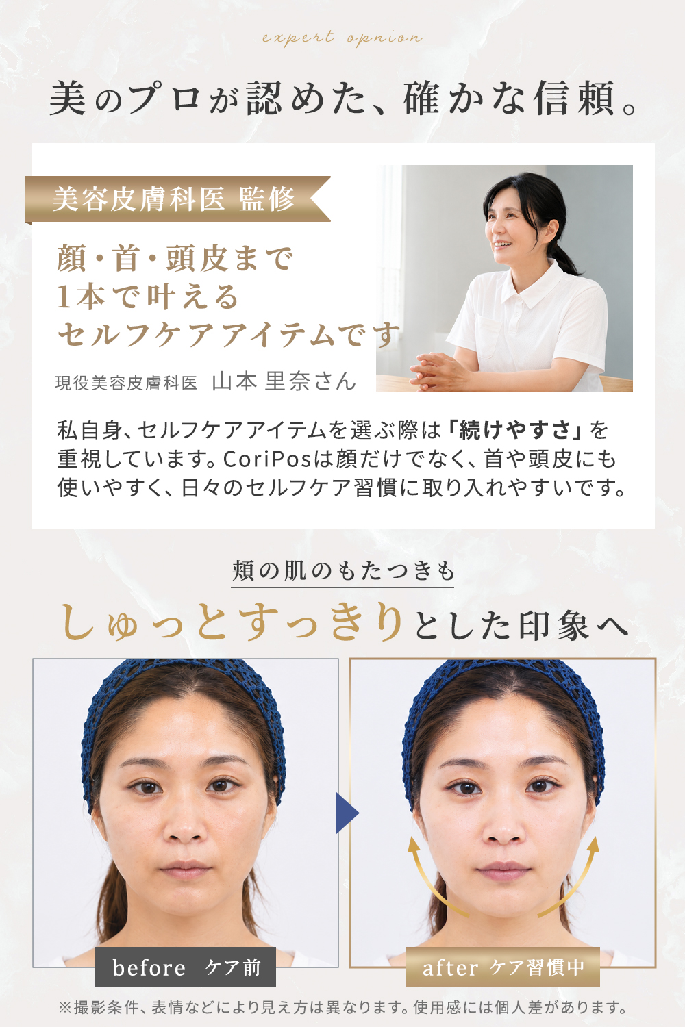 ペン型美顔器 ポスポス CoriPos テラヘ...の詳細画像4
