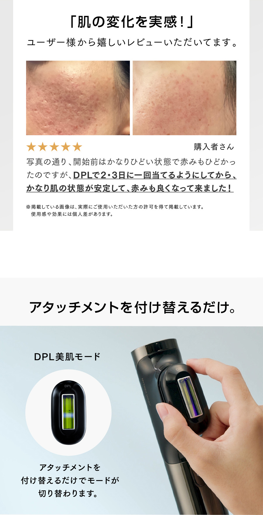 美品✨MYTREX MIRAY ミレイ DPL/IPL光美容器 MYTREX（マイトレックス） 公式 MiRAY 脱毛器 メンズ IPL DPL ムダ毛
