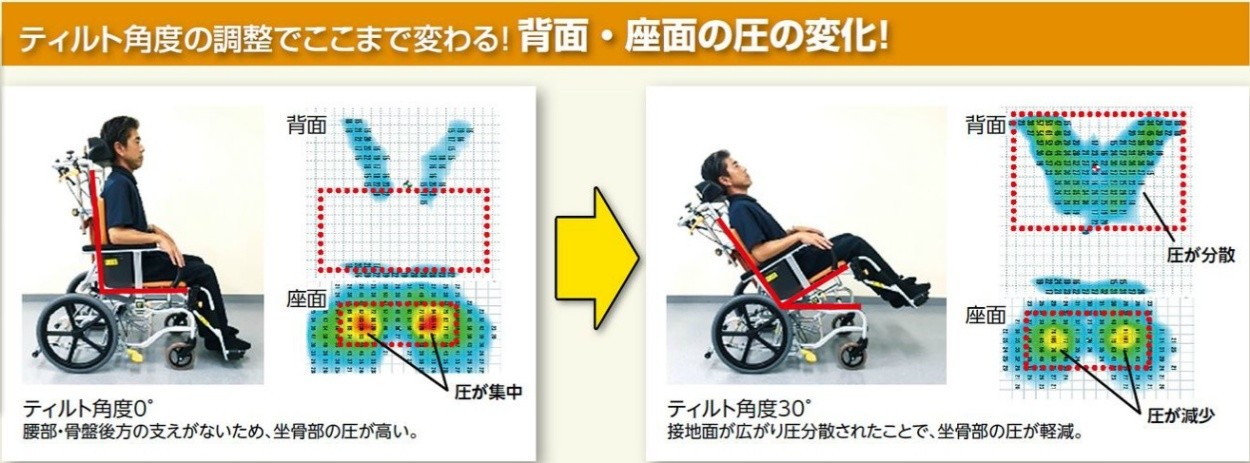 (松永製作所) マイチルト バリュー MH-VR-SE ティルト&リクライニング車いす ノーパンクタイヤ｜sanai-kaigo2｜09