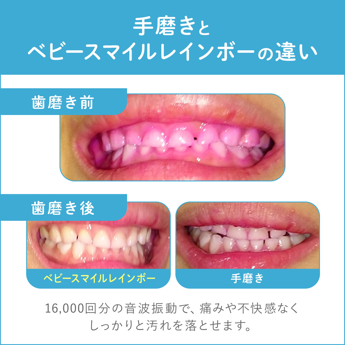 ビフォーアフター