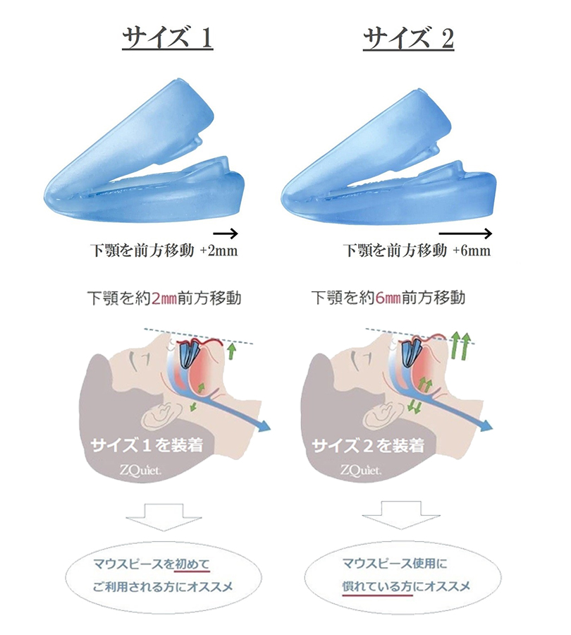 睡眠用マウスピース ズィークワイエット 本体のみ サイズ1