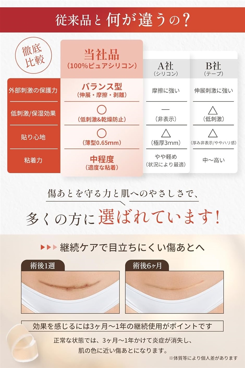 美容皮膚科医監修傷跡ケアテープ 帝王切開 低刺激 x 貼り心地にもこだわった シリコンテープ 傷テープ 保護テープ 傷隠し ケロイド | ブランド登録なし | 05