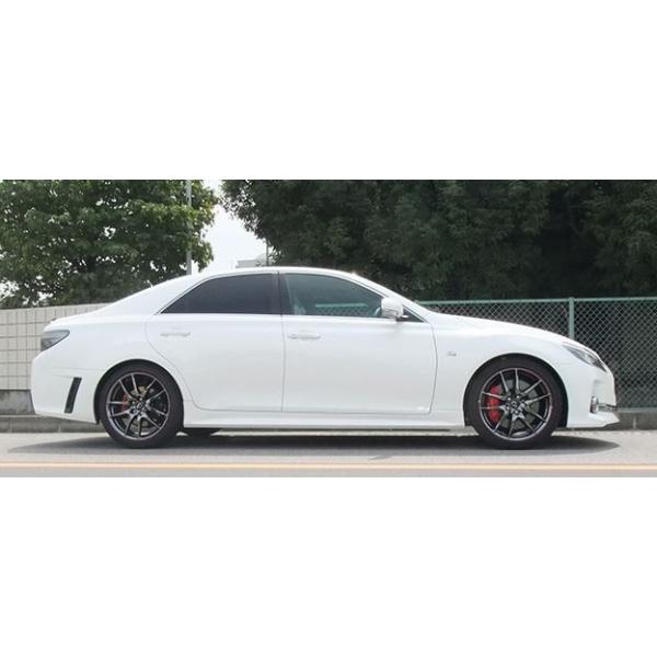 キャンセル不可商品】 ユージーランドボディ youzealandbody SSキット