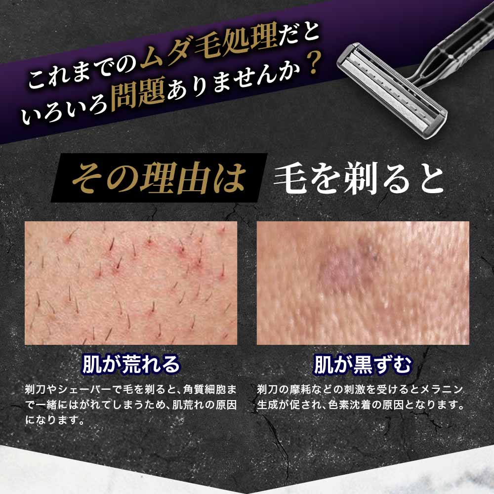 ゼノクス オメガショット 家庭用 メンズ サロンクオリティ ムダ毛機器