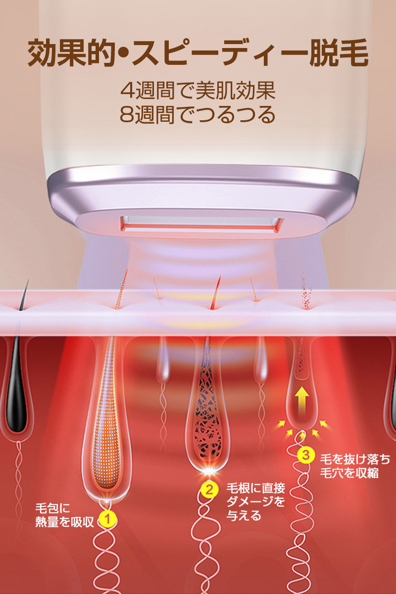 ❤医学美容で使われる脱毛効果の顕著な長光波＆サロンのプロのIPL光