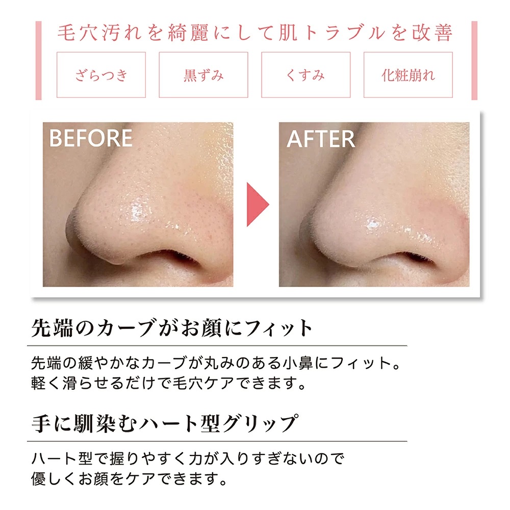 角栓 黒ずみ U-ni角栓クリーナー 毛穴 ピーリング 角質取り 顔 毛穴