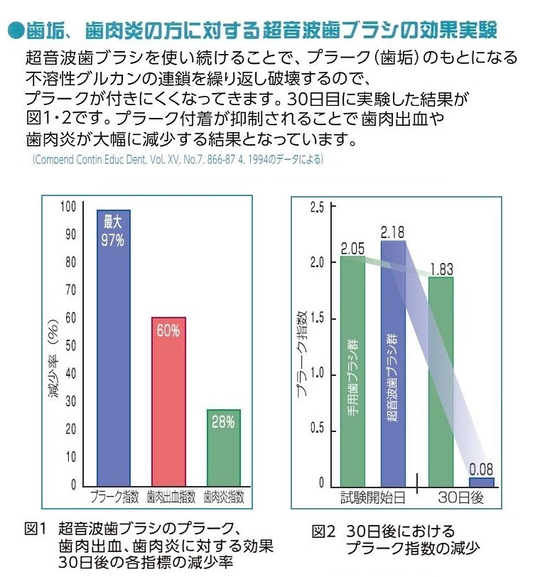 超音波歯ブラシ 電動歯ブラシ 音波歯ブラシ スマイルエックス AU-300D 選べる替えブラシ2パック付 ボタン色が3色から選べます | 朝日医理科 | 09