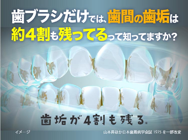 やわらか歯間ブラシ 極細タイプ SSS〜Sサイズ 歯ぐきにやさしいゴム