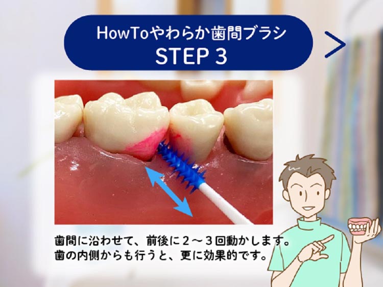やわらか歯間ブラシ 超極細タイプ SSSS〜SSサイズ 歯ぐきに