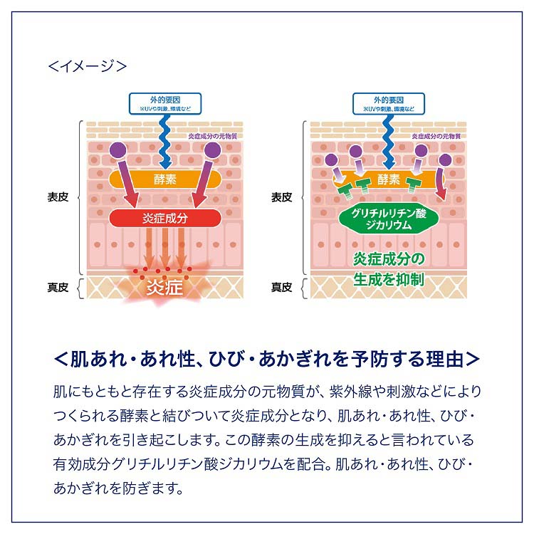ヴァセリン メディケイティッド センシティブケア ボディ