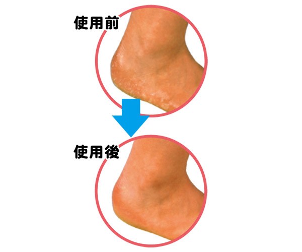 足指小町 角質用 かかとつるつるシルクハードスポンジ ( 1個入