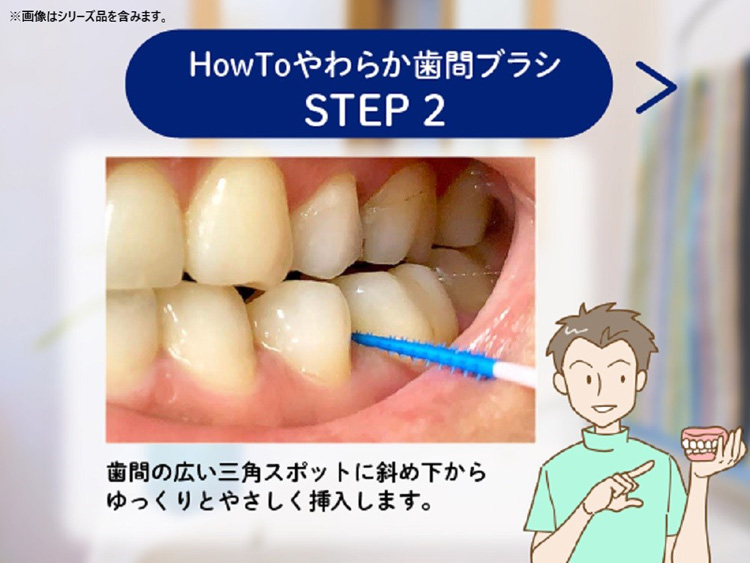 Amazon | 【幕張文具4A】 歯間ブラシ L字型 極細タイプ サイズ2