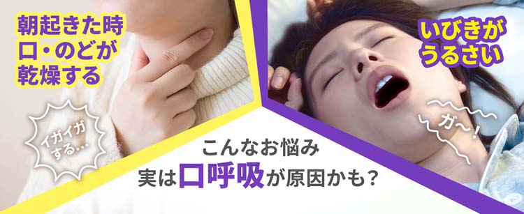 ナイトミン　鼻呼吸テープ　いびき　のどの乾燥　アロマラベンダーの香り　10個 Amazon.co.jp: ナイトミン 鼻呼吸テープ 口・のどの乾燥・いびき