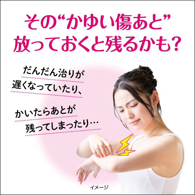 Amazon | 【第2類医薬品】アットノンEXk Plus 10g | アットノン