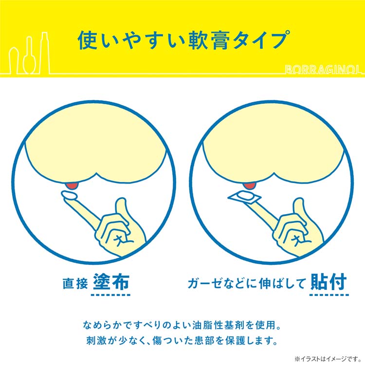 第(2)類医薬品)ボラギノールA軟膏 ( 20g )/ ボラギノール :4987123134781:爽快ドラッグ - 通販 - Yahoo!ショッピング