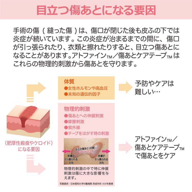 アトファイン Mサイズ ( 6枚入 ) : 爽快ドラッグ - 通販 - Yahoo