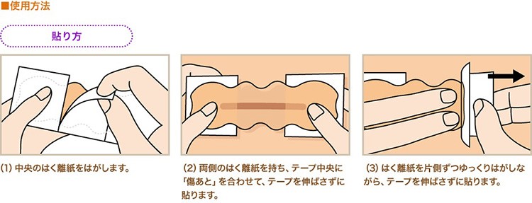 アトファイン Lサイズ ( 6枚入 ) : 4987167081942 : 爽快ドラッグ