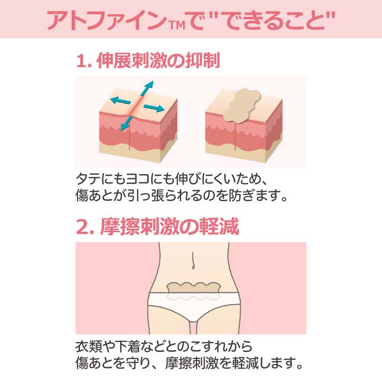アトファイン 傷あとケアテープ Mサイズ ( 3枚入 ) : 爽快ドラッグ