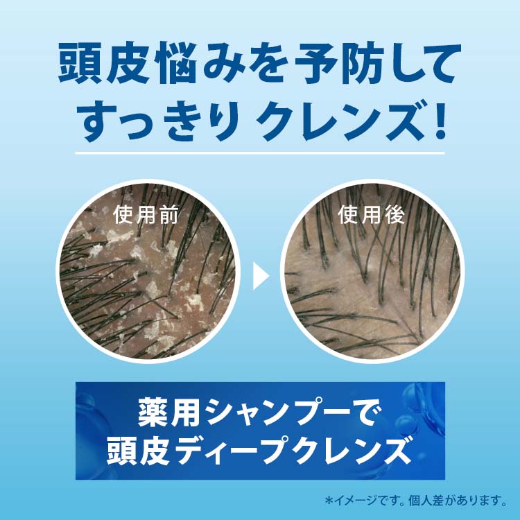 h＆s モイスチャー シャンプー つめかえ ( 315ml )/ h＆s(エイチ