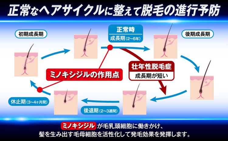 第1類医薬品)大正製薬 リアップ ( 60ml )/ リアップ 発毛 育毛