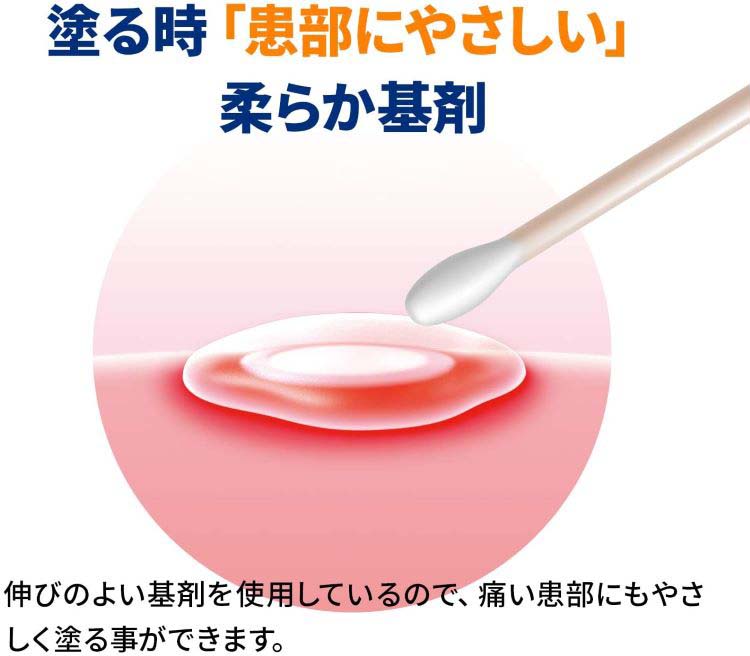 第(2)類医薬品)アフタガード ( 5g(セルフメディケーション税制